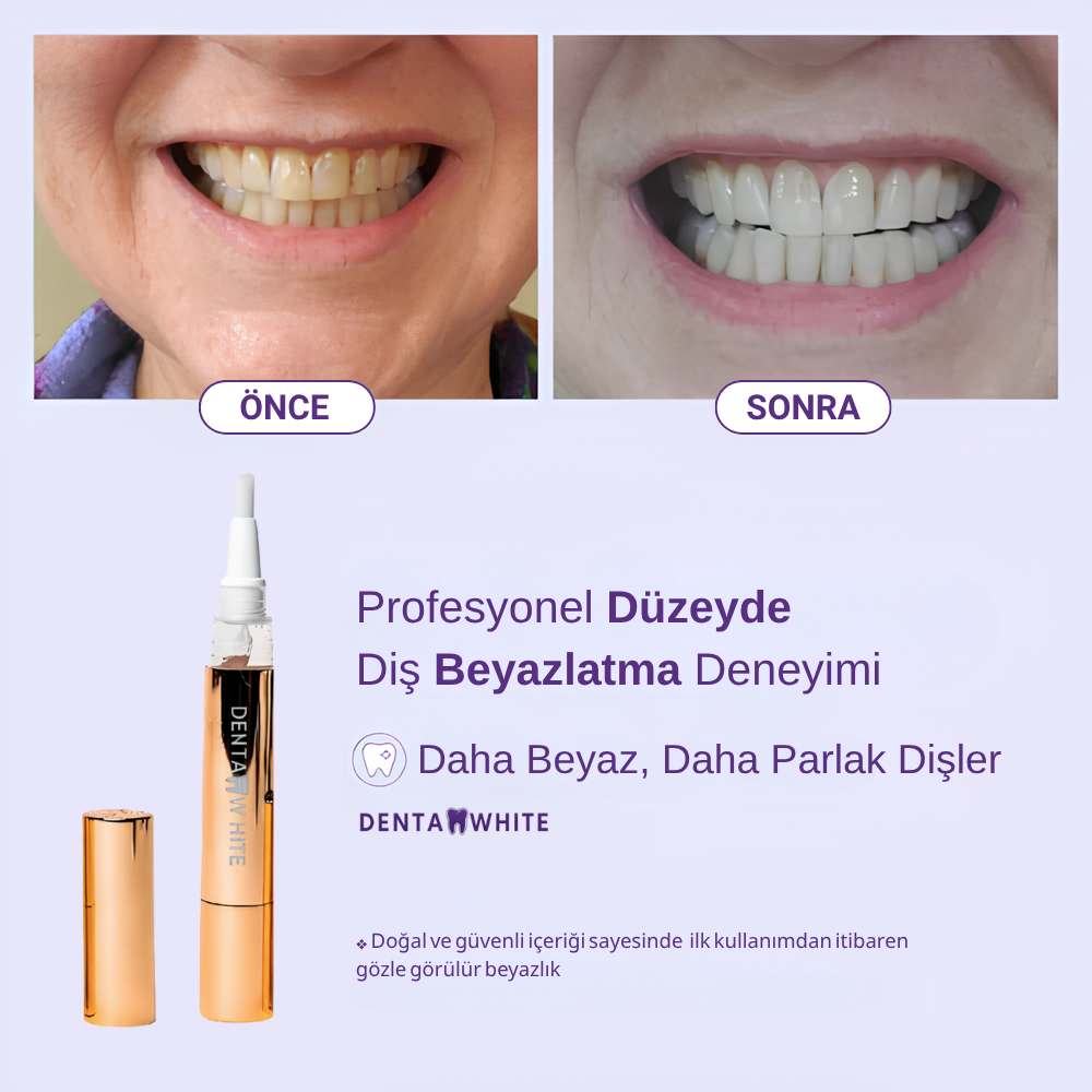 Ekstra Güçlü Diş Beyazlatma Kalemi